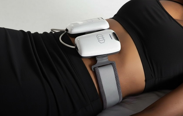 Coolsculpting on stomach